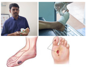 Exploring the Finest Podiatry Clinics in Chennai for Comprehensive Foot Care